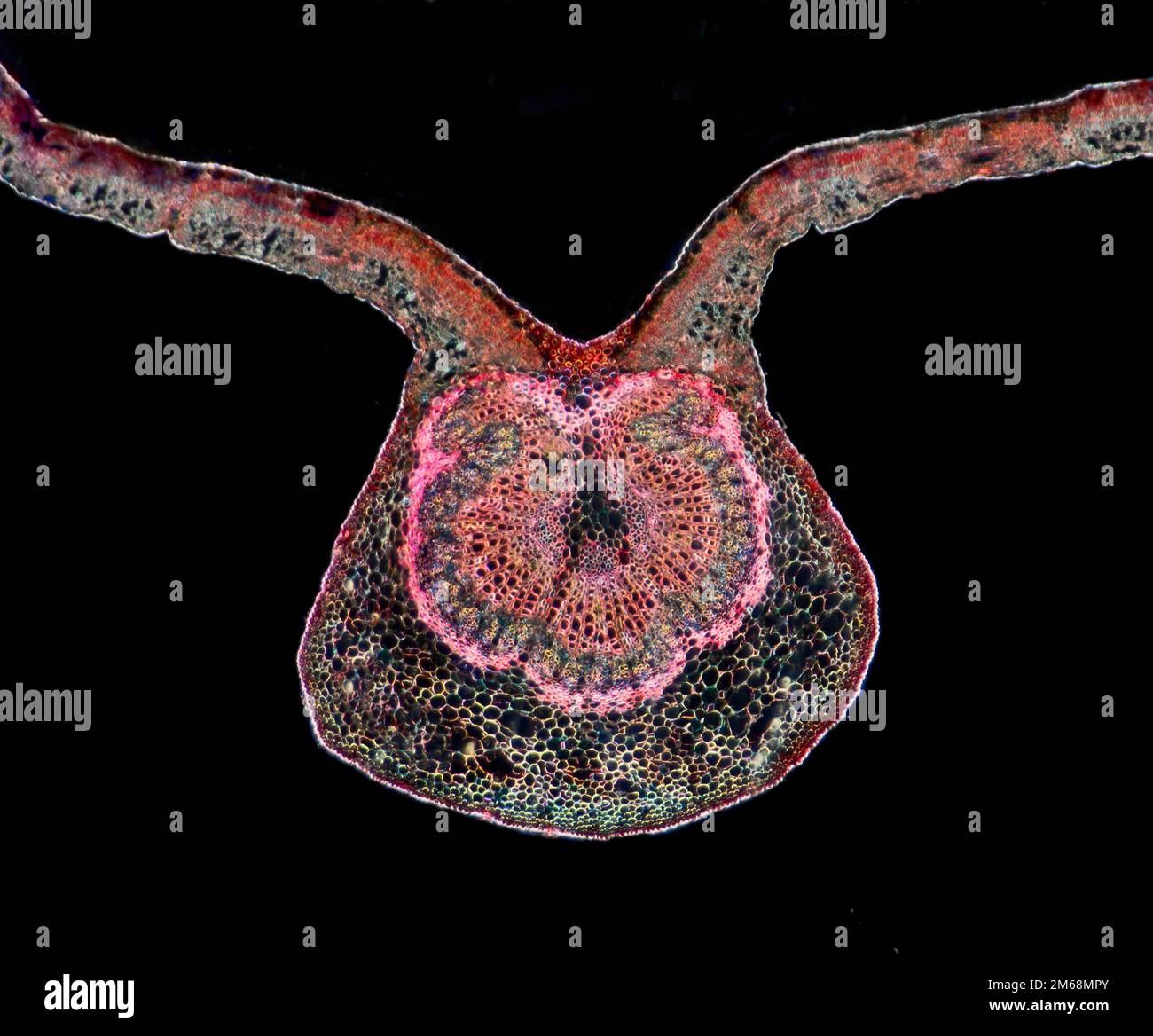 Aulne alnus glutinosa, feuille TS. photomicrographe à fond noir Banque D'Images