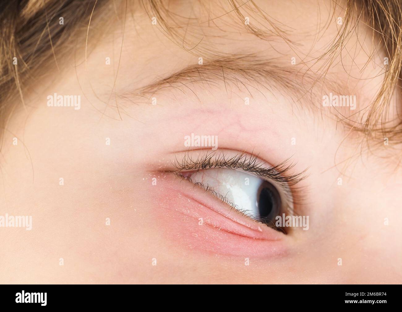 L'oeil rose sur un garçon, avec gros plan sur les yeux marron et les cheveux brun Banque D'Images