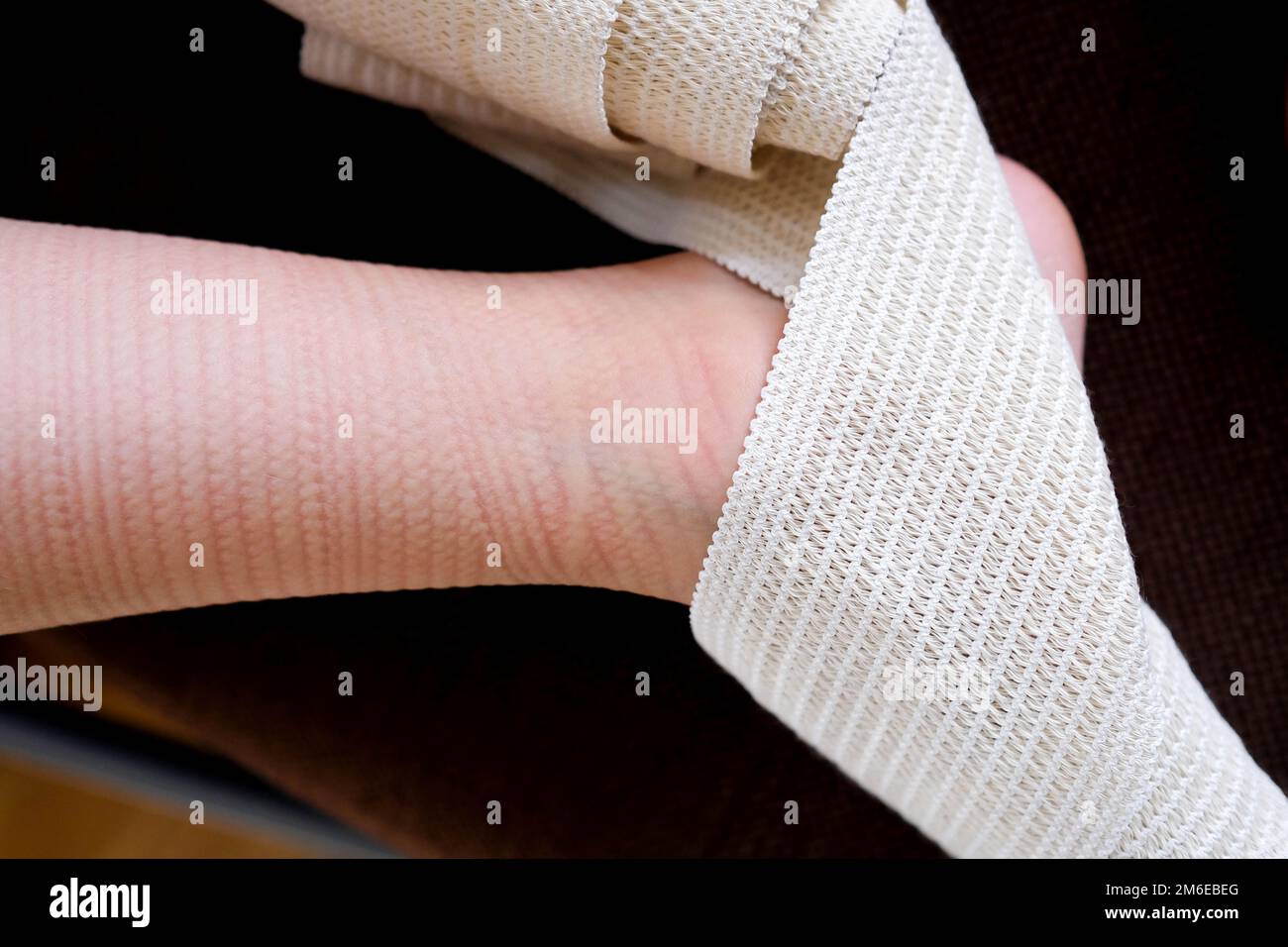 Un schéma sur la peau d'un bandage médical. Le bandage élastique a comprimé la peau Banque D'Images