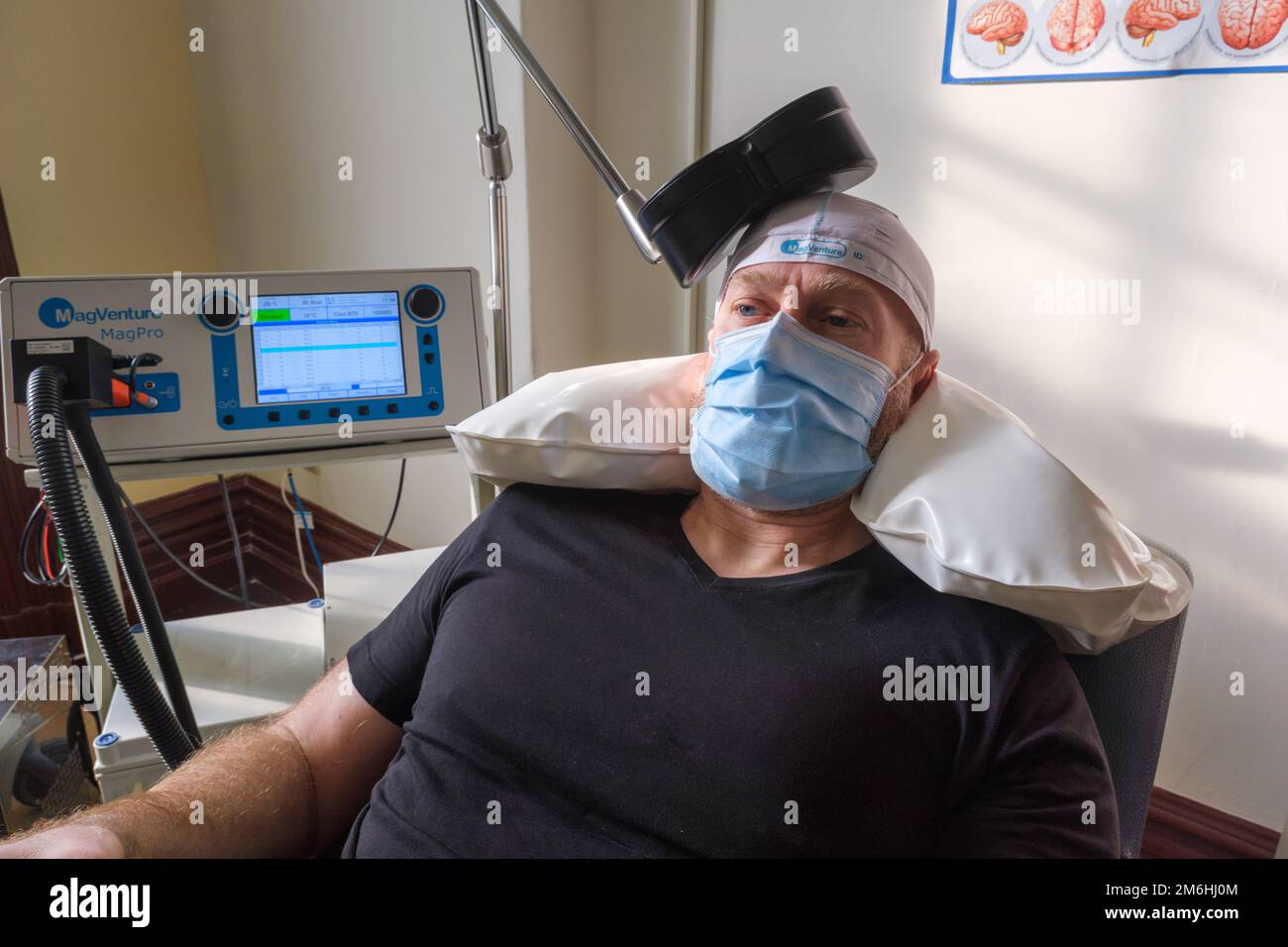 Montréal, CA - 15 novembre 2022 : patient subissant une stimulation magnétique transcrânienne répétitive (TMS) pour traiter l'anxiété et la dépression Banque D'Images