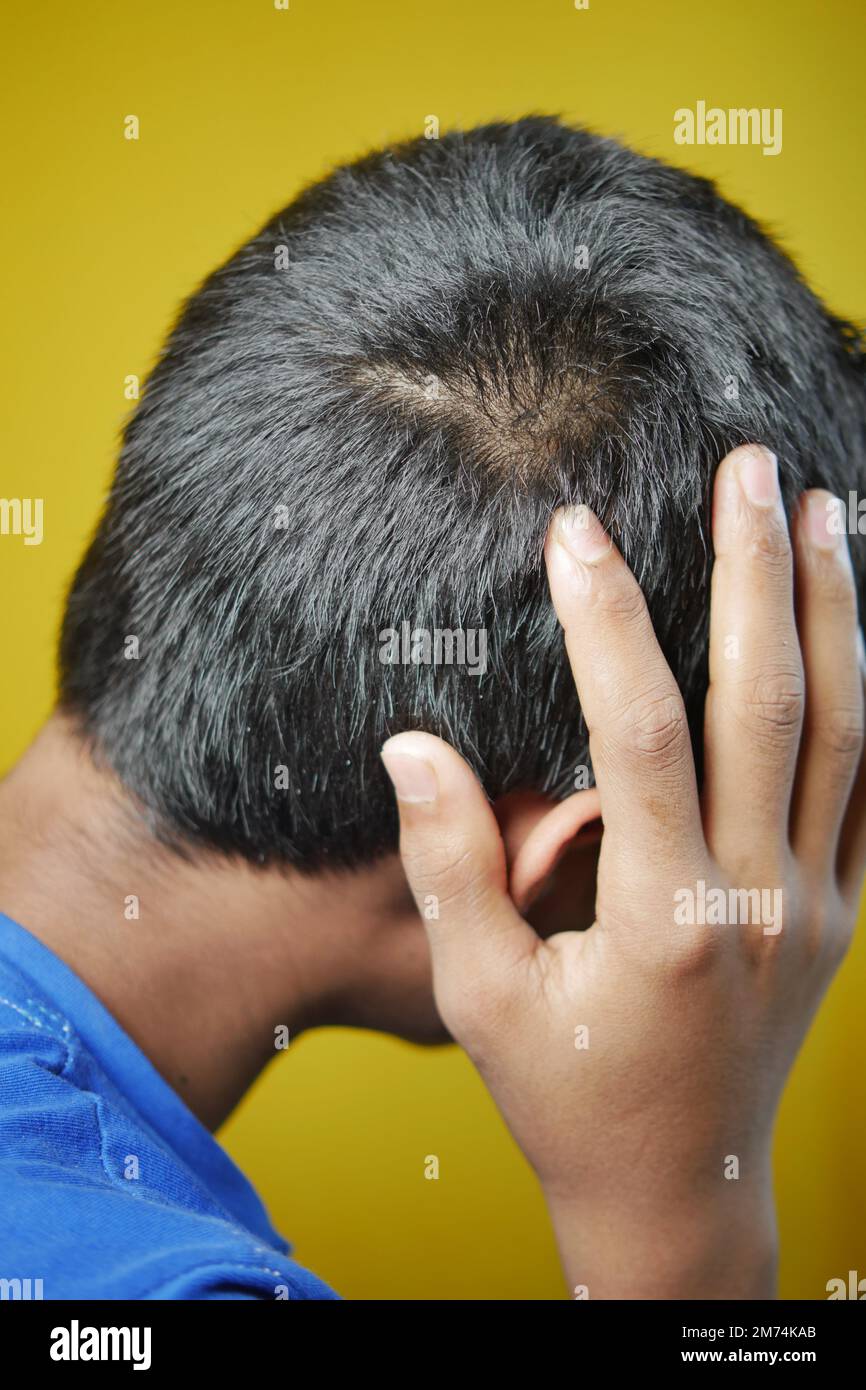 concept de perte de cheveux avec l'homme vérifiant ses cheveux Banque D'Images