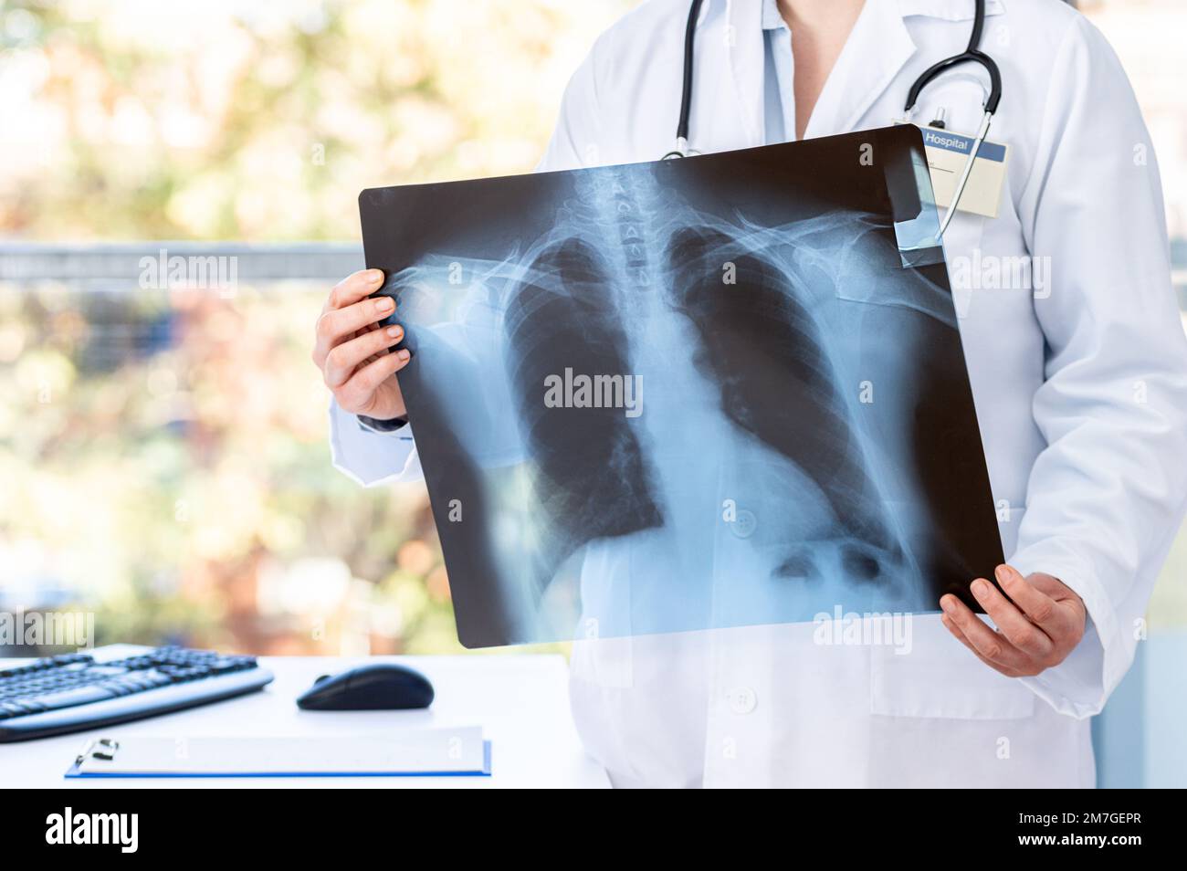 Médecin diagnostiquant la santé du patient sur l’asthme, la maladie pulmonaire, la longue COVID-19, le coronavirus ou la maladie du cancer des os avec un film radiographique thoracique pour m Banque D'Images