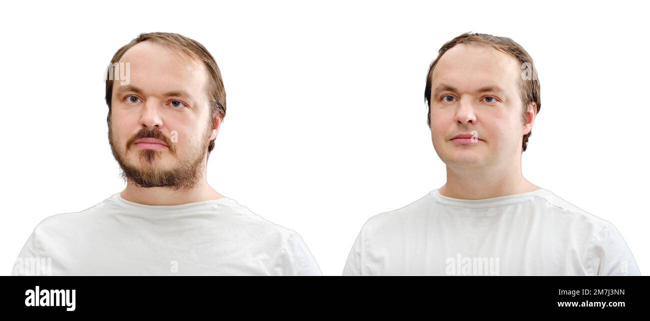 Avant et après le rasage, isoler sur un fond blanc. Portrait de collage d'un homme avec une barbe et sans barbe, isolé sur un fond blanc Banque D'Images