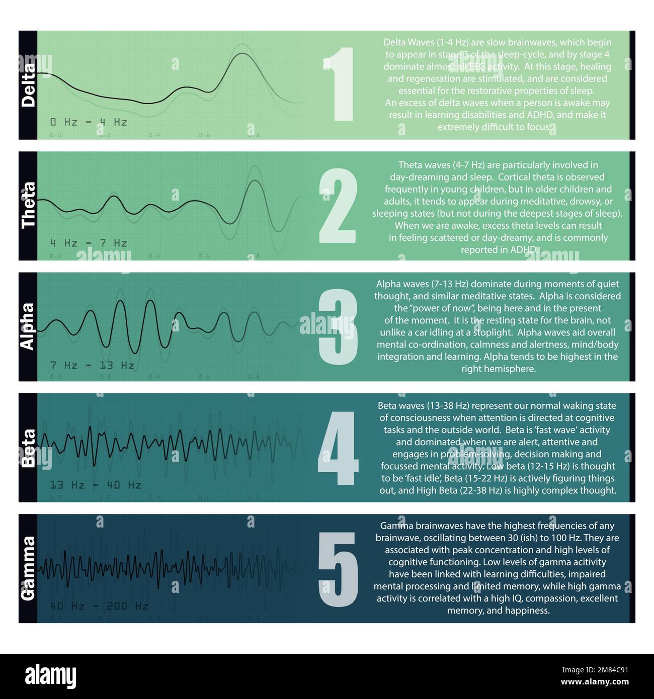 Jeu de graphiques couleur des ondes cérébrales Illustration de Vecteur
