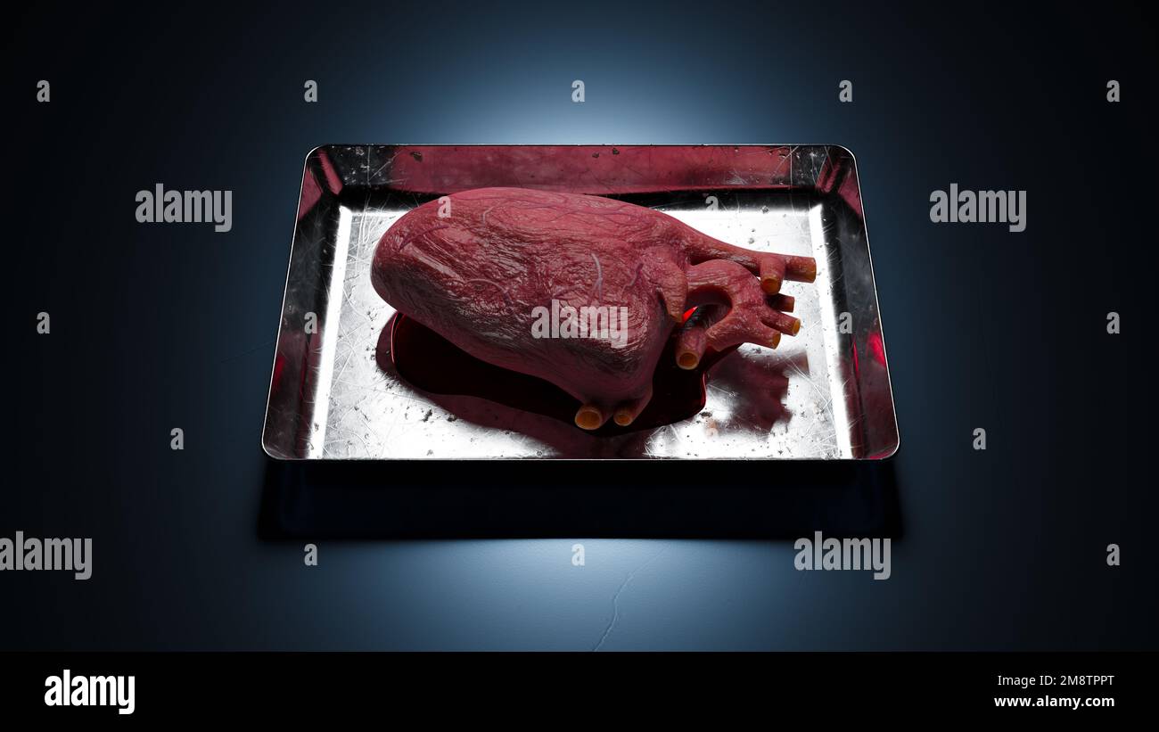 Coeur pour la transplantation sur un plateau en acier inoxydable - le concept d'une opération humaine de transplantation d'organe interne Banque D'Images