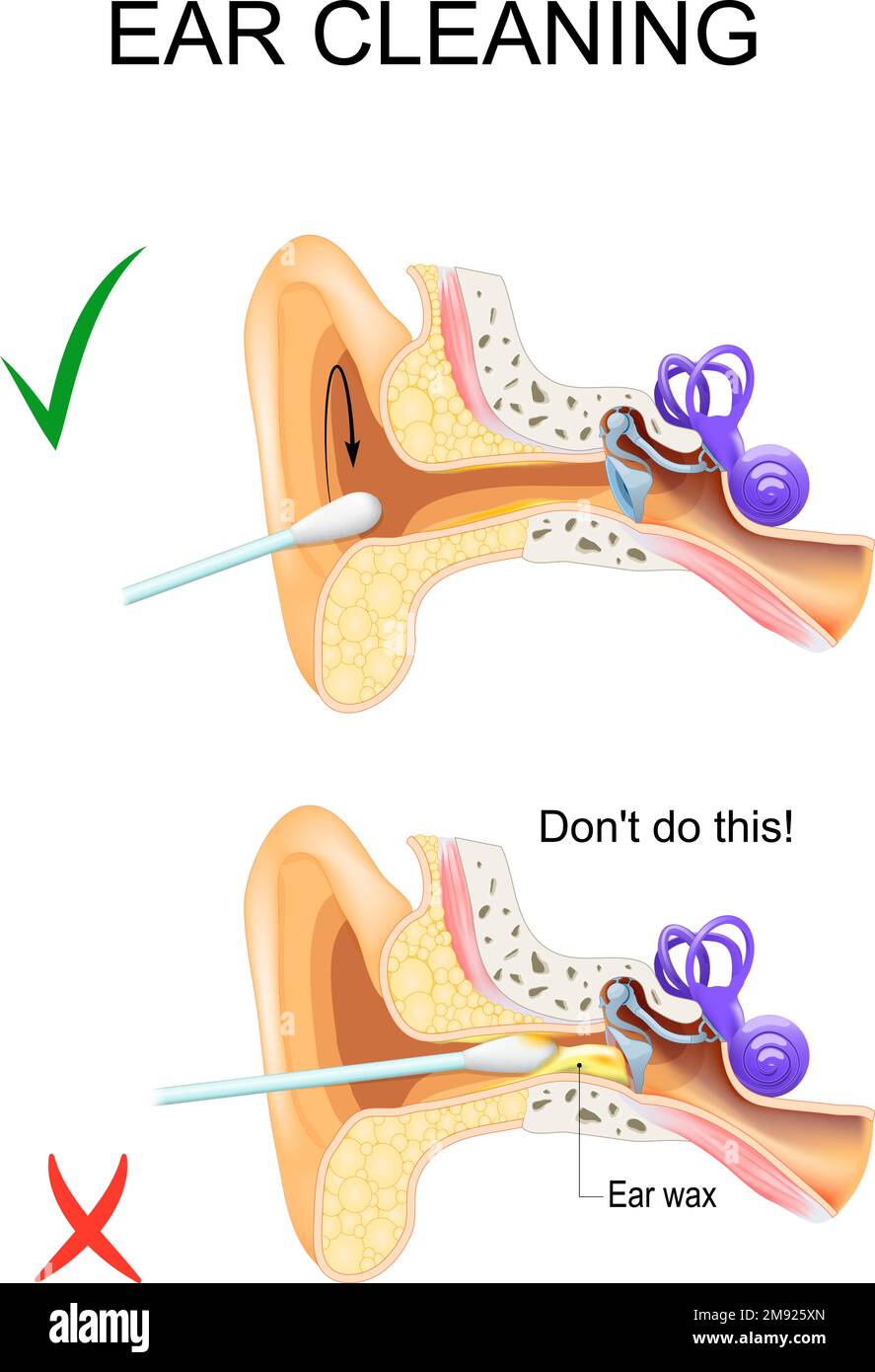 Nettoyage des oreilles Banque d'images vectorielles - Alamy