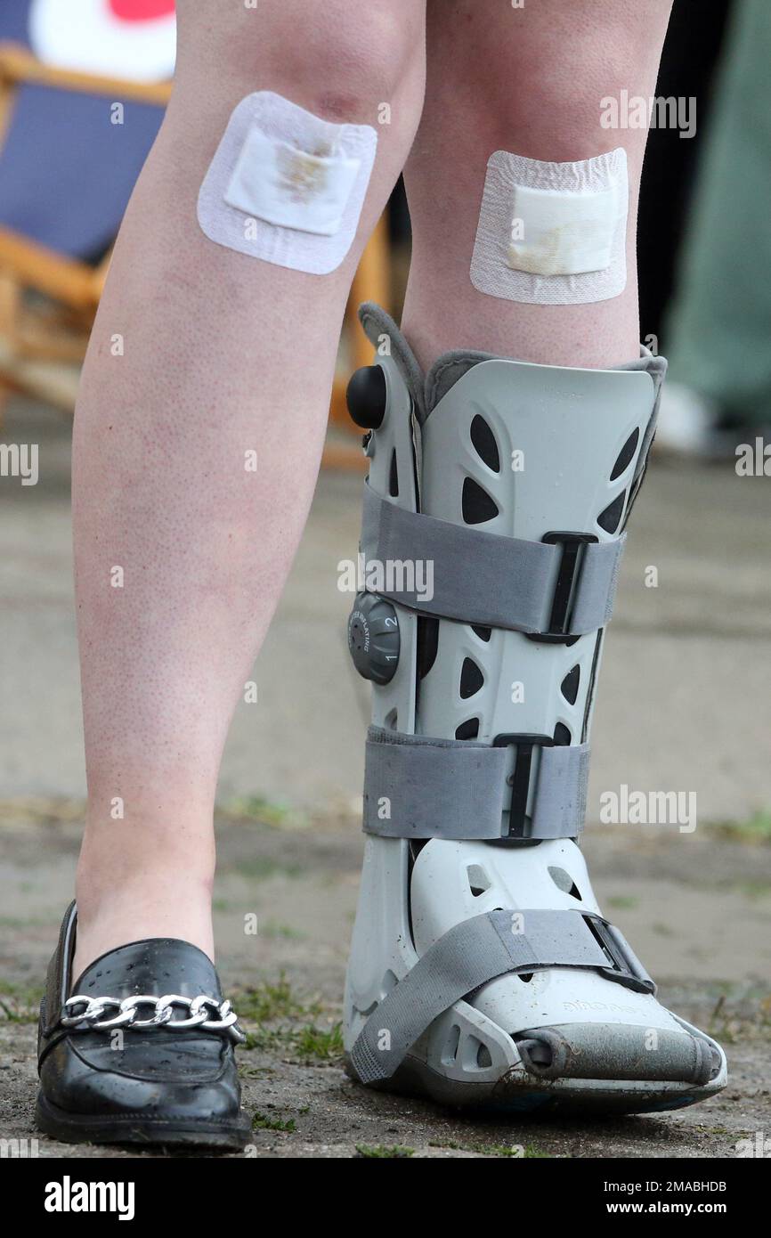 07.07.2022, Allemagne, Saxe, Leipzig - gros plan: Femme portant du plâtre sur ses genoux et une orthèse pied-jambe inférieure. 00S220707D536CAROEX.JPG [MODÈLE RELE Banque D'Images