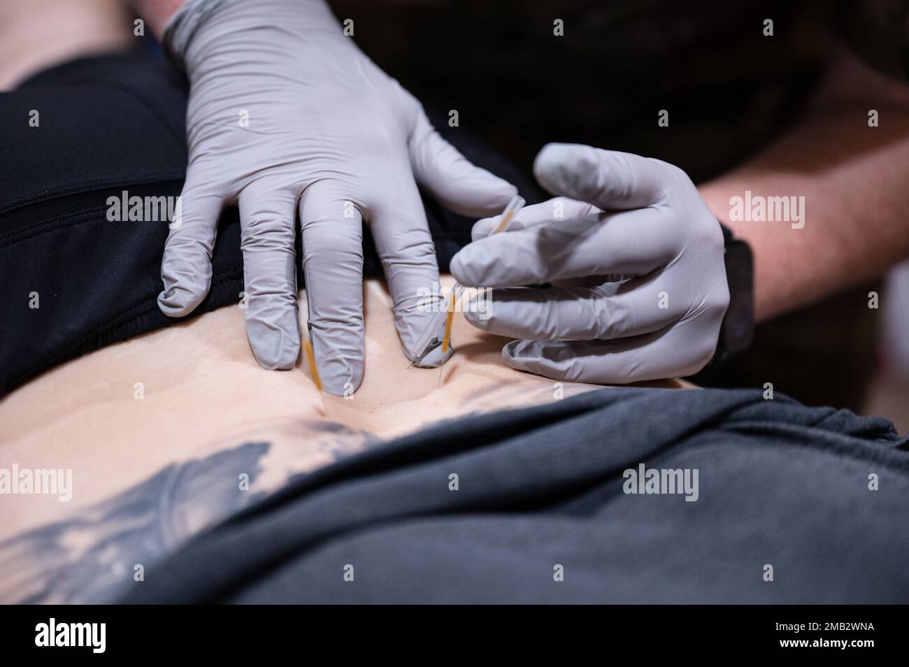 ÉTATS-UNIS Le capitaine de la Force aérienne Kara Heath, un physiothérapeute du 379th Expeditionary Operational Medical Readiness Squadron, base aérienne d’Al Udeid, au Qatar, utilise des aiguilles sèches sur le bas du dos d’un Airman pour activer des points de déclenchement qui aident à soulager la douleur, 10 juin 2022. Être traité avec des aiguilles sèches est l'une des multiples facettes du traitement reçu par Airman dans le cadre de sa séance de traitement de physiothérapie. Banque D'Images
