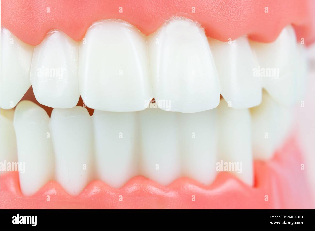 Vue avant de la prothèse complète. Concept dentaire. Fausses dents, mâchoires. Photo conceptuelle de la dentisterie. Dentisterie prothétique. Fausses dents. Fausse dent ou dent Banque D'Images