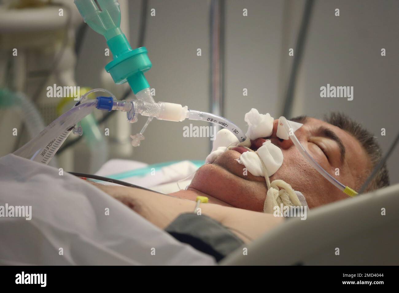 A patient is intubated in the COVID-19 ICU section of the University Clinical Centre hospital in Banja Luka, Bosnia, Thursday, Nov. 4, 2021. Watching with fear as virus rages in neighboring countries, doctors in Bosnia are bracing for a looming new wave in the Balkan nation that has a low vaccination rate and has been among the hardest hit countries in Europe in previous periods of the pandemic.(AP Photo) Banque D'Images