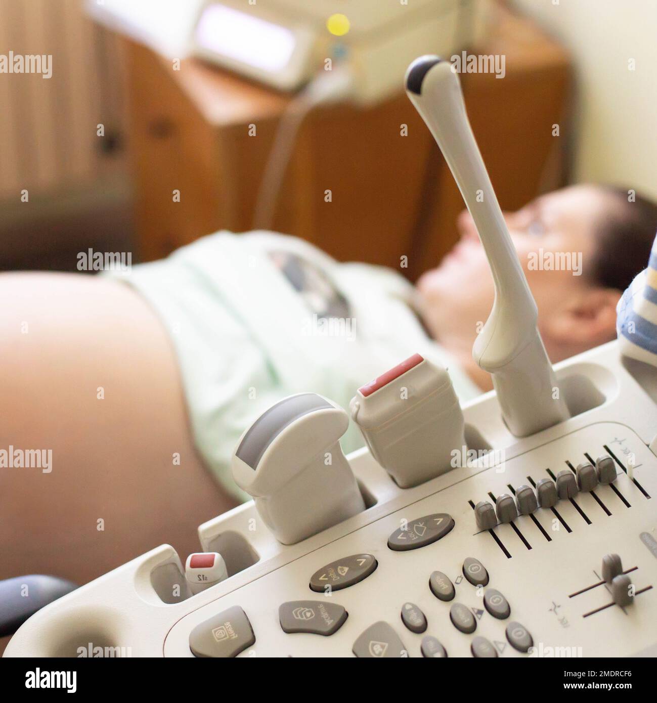 Échographie médicale du fœtus d'une fille enceinte. Présentation fœtale, fetométrie, enchevêtrement de cordon, et maturité placentaire, gynécologie Banque D'Images