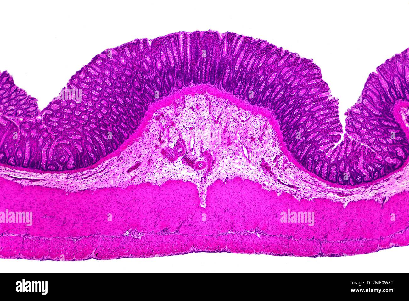 Section colorée en appendice humain, photomicrographe à fond clair Banque D'Images