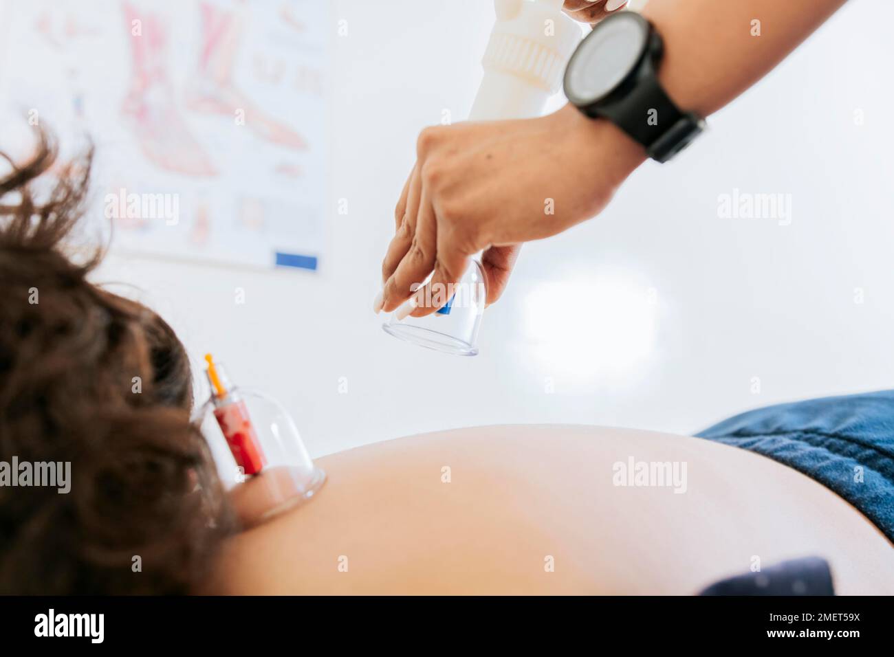 Kinésithérapeute plaçant le trempage sur le patient, traitement de kinésithérapie professionnel avec le trempage sur un patient couché. Physiothérapie moderne avec trempage Banque D'Images