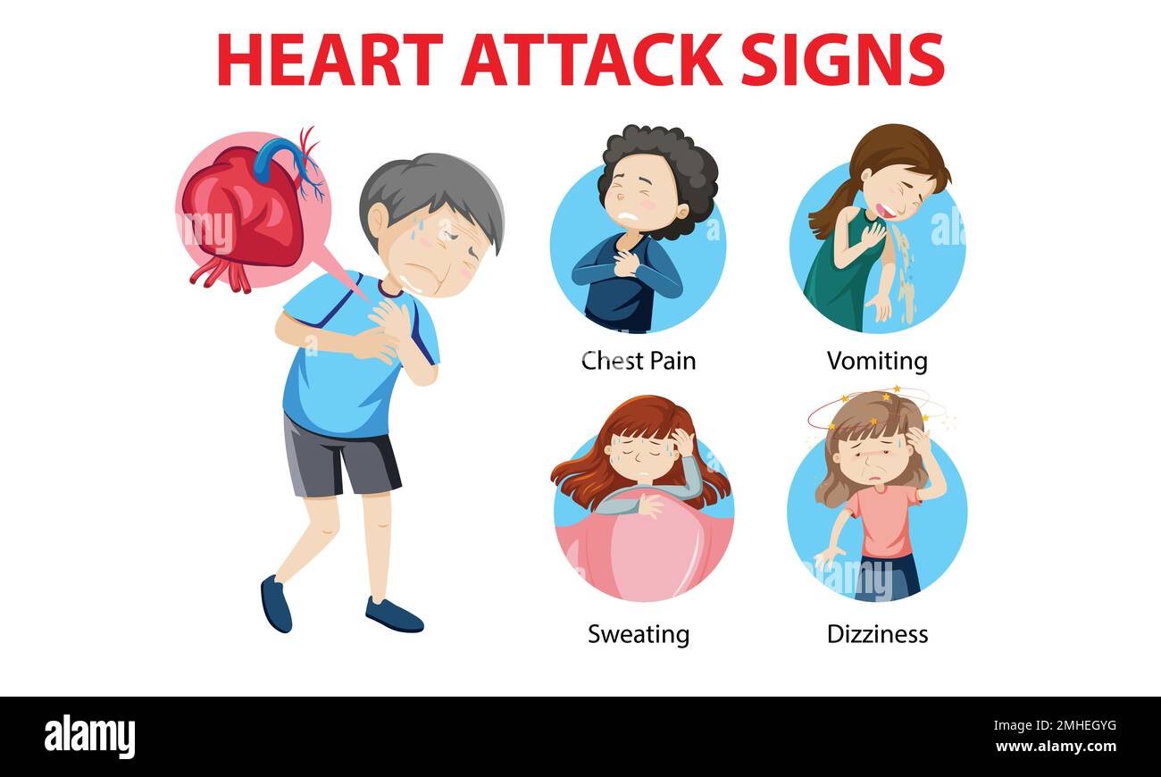 Infographie sur les vecteurs d'attaque cardiaque. Symptômes de crise cardiaque. Éléments infographiques. Illustration de Vecteur