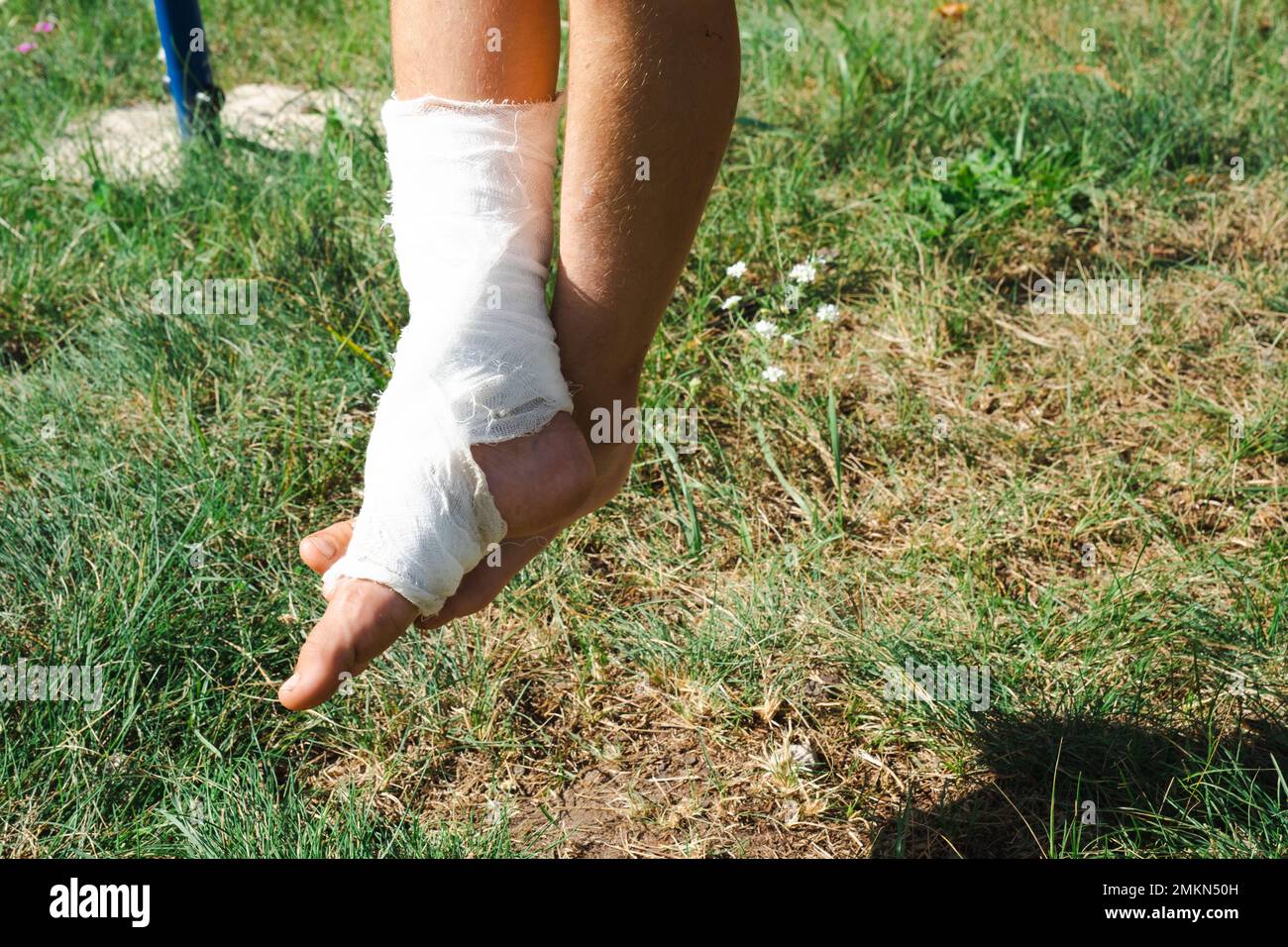 Les jambes des enfants sont bandées en plâtre - pieds nus sur une balançoire. Équipement traumatique, blessure d'enfant, ecchymoses, entorse, fracture Banque D'Images
