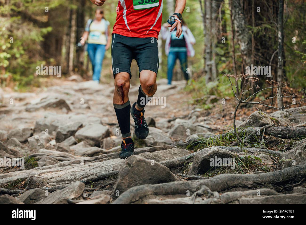 le coureur sportif avec du sang sur ses genoux court un sentier forestier Banque D'Images
