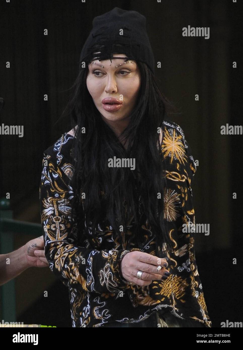 Reality TV et Pete Burns (You Spin Me Round), la star pop des années 80, fait du shopping à Soho avec un petit ami et montre simultanément les effets choquants de plusieurs chirurgies du visage en plastique. Burns et son petit ami, qui semble avoir juste eu une chirurgie faite sur son visage bandé, portent des jeans aussi aggeux et tiennent les mains pendant qu'ils marchent. Londres, Royaume-Uni. 10/07/10. Banque D'Images