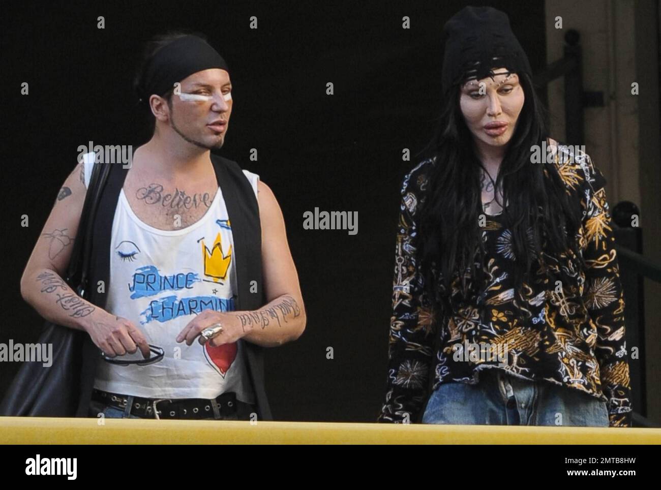 Reality TV et Pete Burns (You Spin Me Round), la star pop des années 80, fait du shopping à Soho avec un petit ami et montre simultanément les effets choquants de plusieurs chirurgies du visage en plastique. Burns et son petit ami, qui semble avoir juste eu une chirurgie faite sur son visage bandé, portent des jeans aussi aggeux et tiennent les mains pendant qu'ils marchent. Londres, Royaume-Uni. 10/07/10. . Banque D'Images