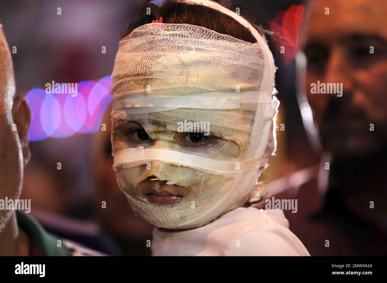 2016 AP YEAR END PHOTOS - Asal Ahmed, 4, is carried by her father at the scene of a massive suicide truck bomb attack in Karada, Iraq, on July 9, 2016. (AP Photo/Hadi Mizban, File) Banque D'Images