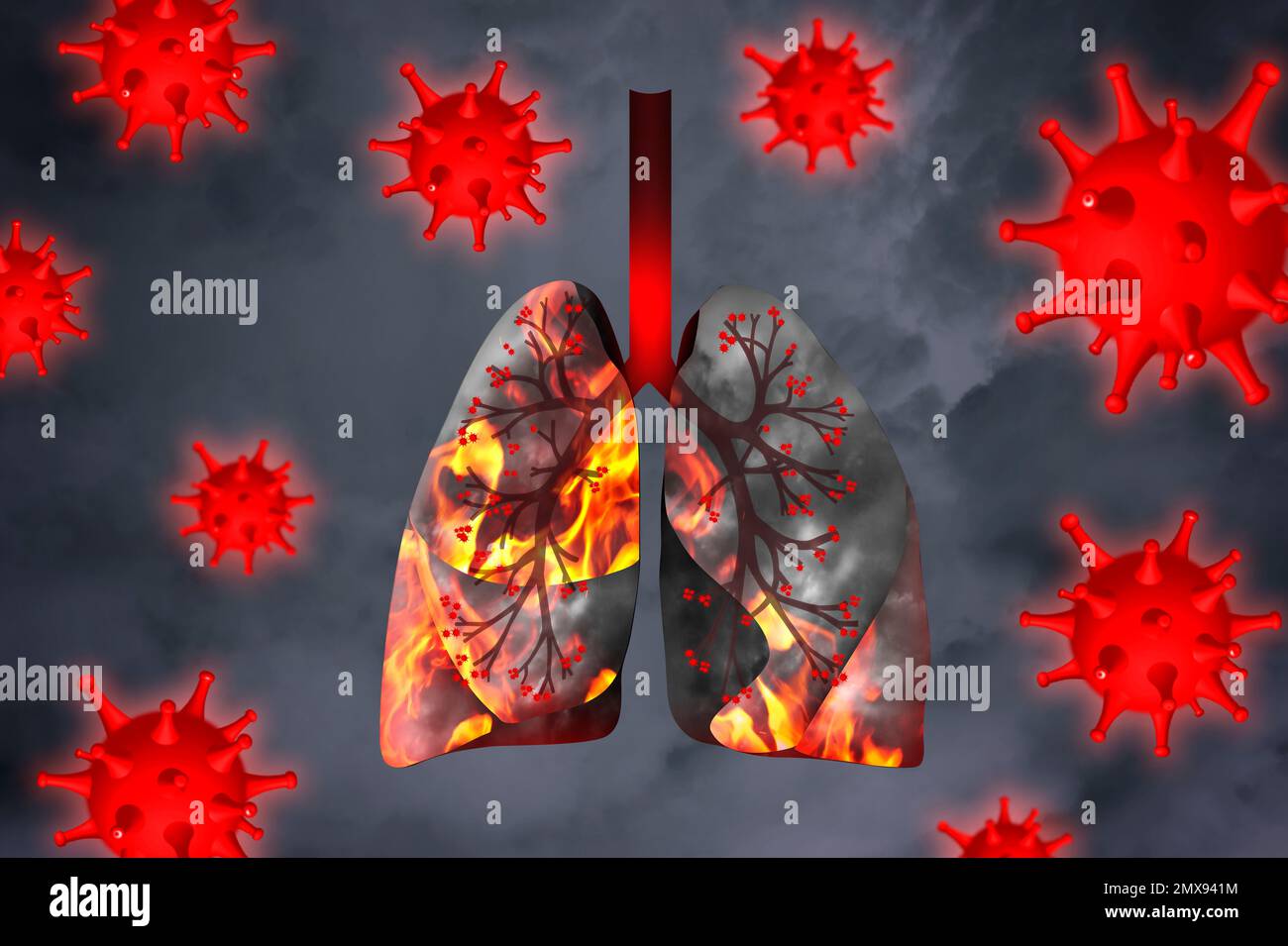 Illustration de poumons humains malades entourés de virus sur fond gris Banque D'Images