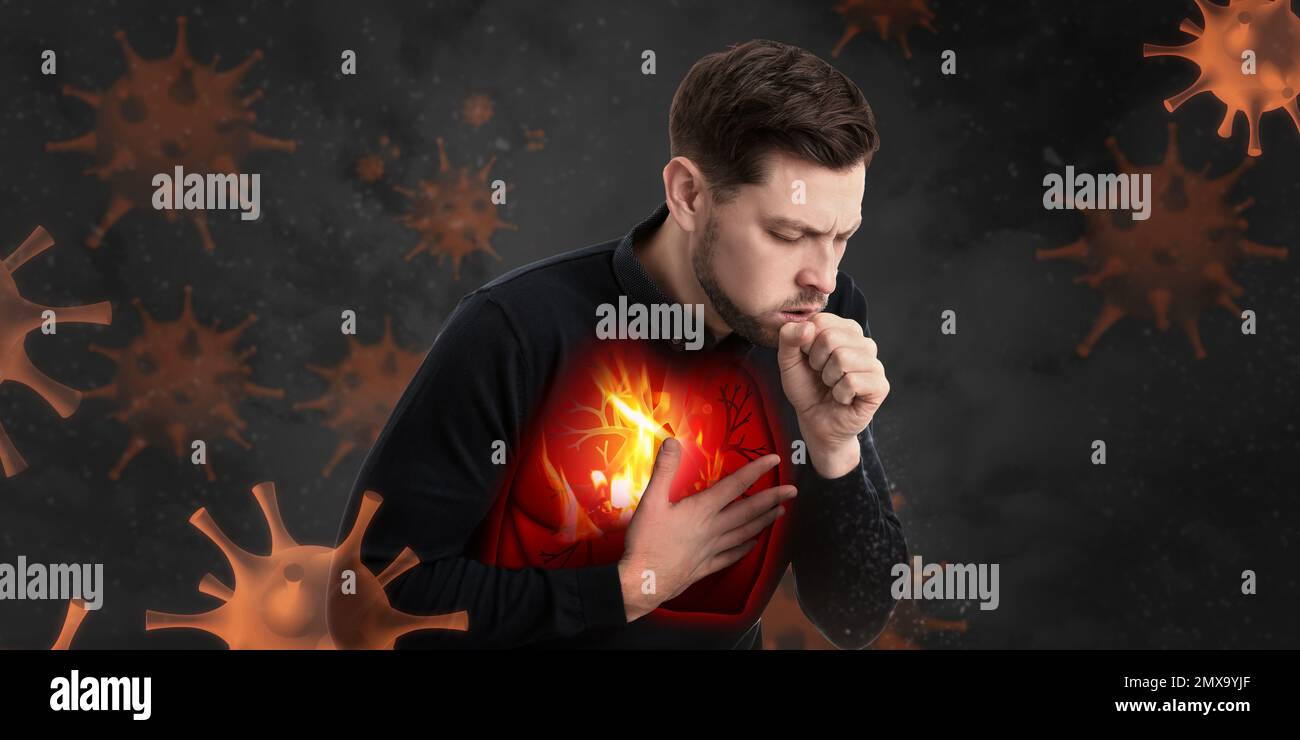 Homme avec des poumons malades entouré de virus sur fond sombre Banque D'Images