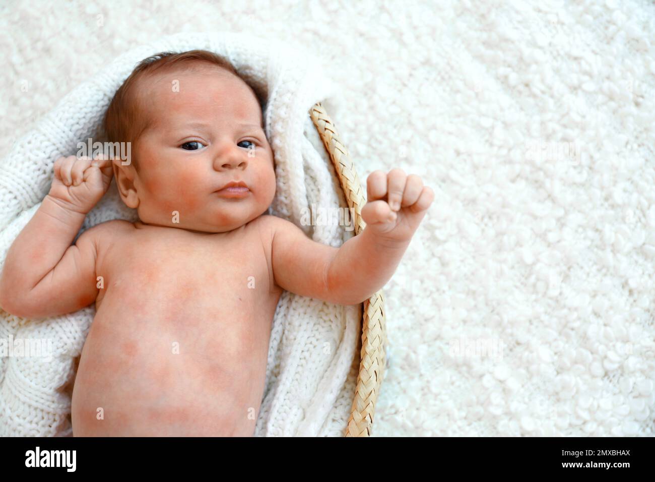 Petit enfant avec une éruption rouge couché dans le berceau, vue de dessus. Allergies de bébé Banque D'Images