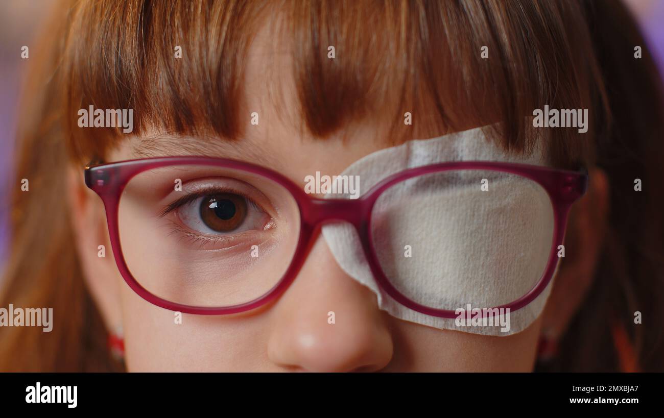 Gros plan portrait de malade visage de fille regardant l'appareil photo, ayant le pansement protecteur patch raye sur un oeil. Blessures, aveugles. Enfant en lunettes. Correction médicale de la thérapie de la vue Banque D'Images