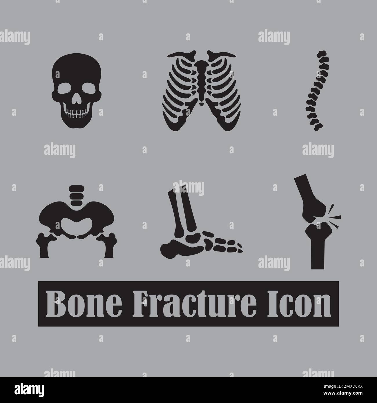 Modèle de conception d'illustration vectorielle d'icône de fracture osseuse. Illustration de Vecteur