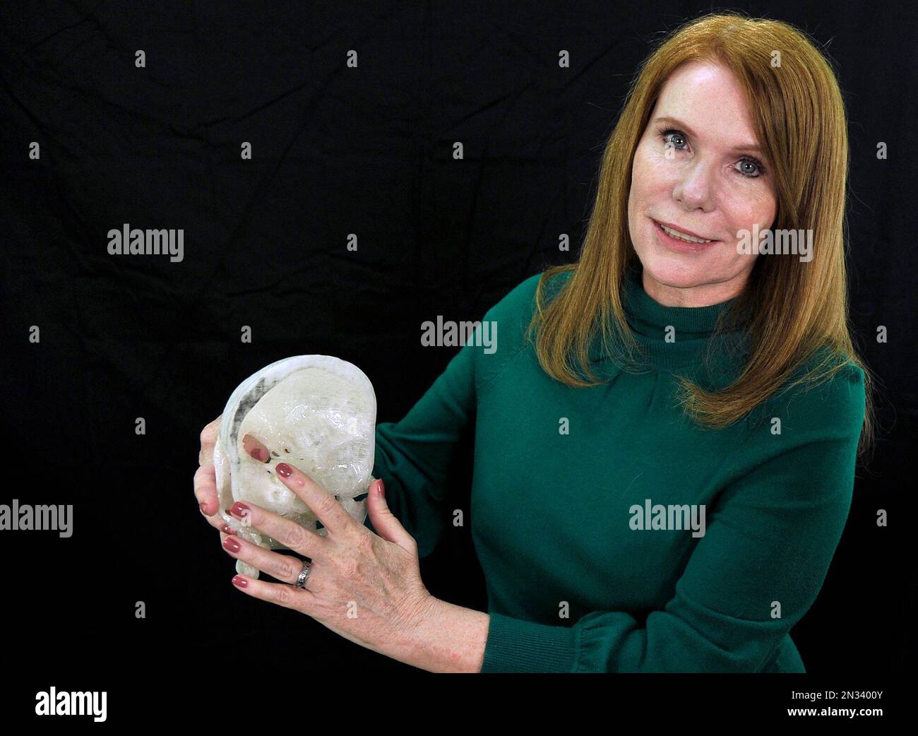 Pamela Shavaun Scott holds a 3D printer model of her skull after her