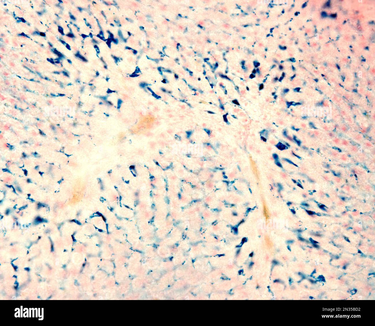 Les cellules de Kupffer sont des macrophages du foie. Le fer colloïdal agit comme une coloration vitale qui peut être introduite dans le corps étant phagocyté par les cellules Kupffer, Banque D'Images