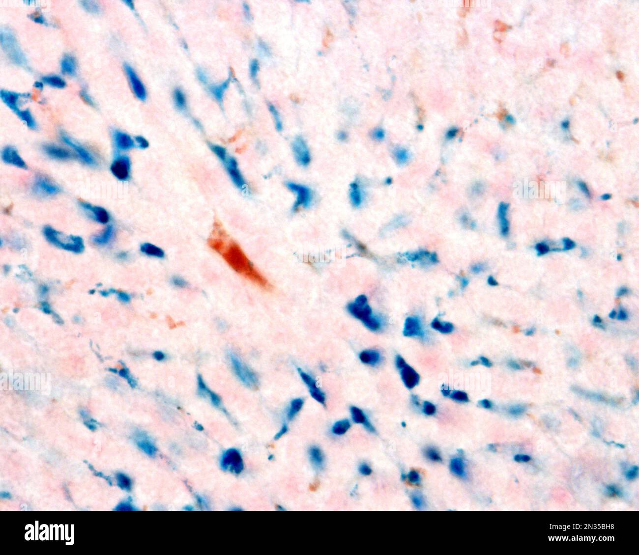 Les cellules de Kupffer sont des macrophages du foie. Le fer colloïdal agit comme une coloration vitale qui peut être introduite dans le corps étant phagocyté par les cellules Kupffer, Banque D'Images