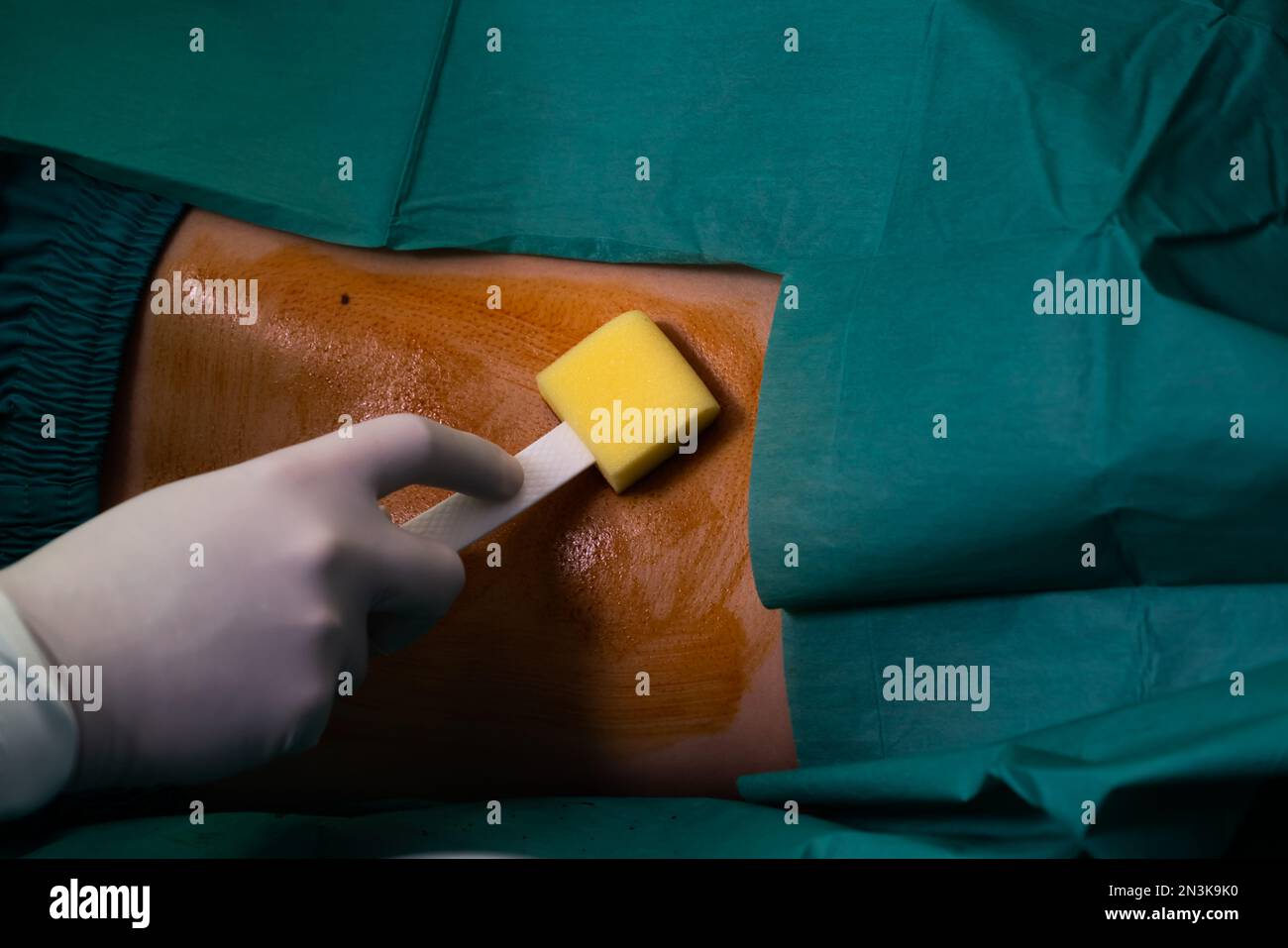 Médecin ou chirurgien appliquez de la bétadine au patient pour une injection d