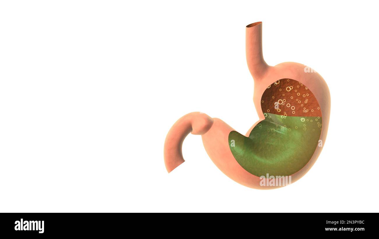 Reflux acide dans l'estomac humain 3D illustration Banque D'Images