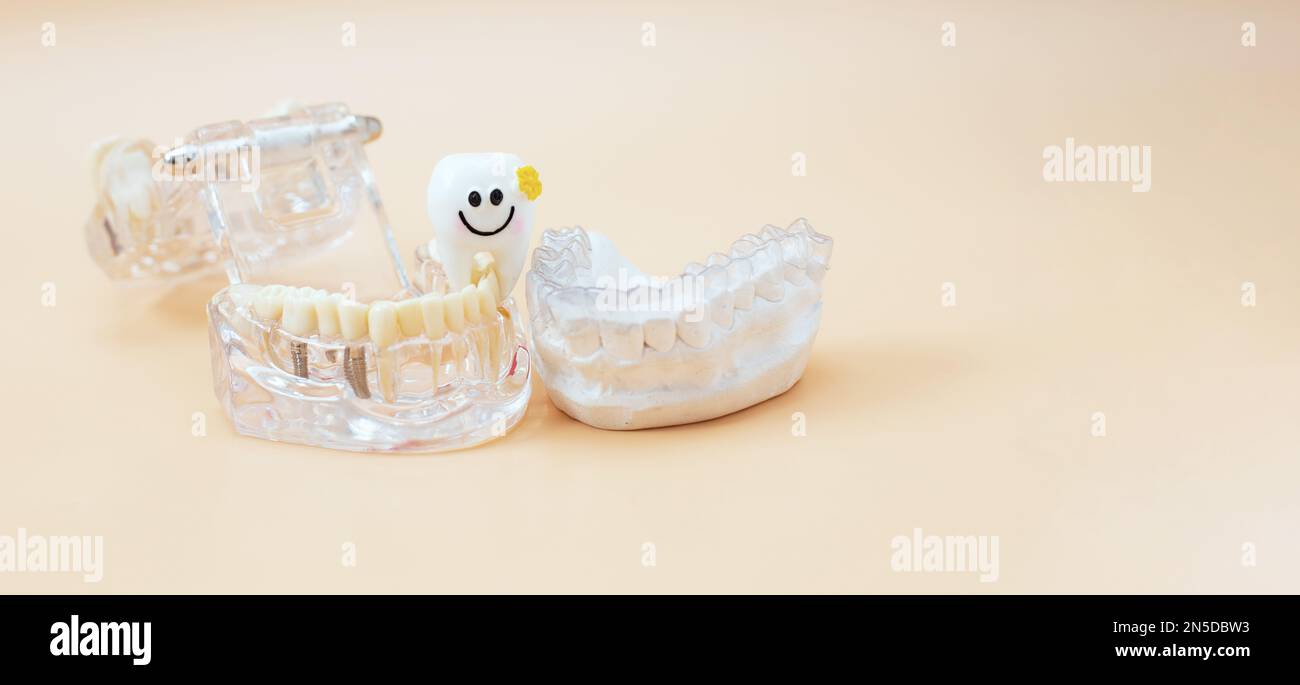 Thème dentaire orthodontique sur fond bleu et jaune.transparent dentaire invisible aligneurs ou accolades pour un traitement dentaire orthodontique Banque D'Images