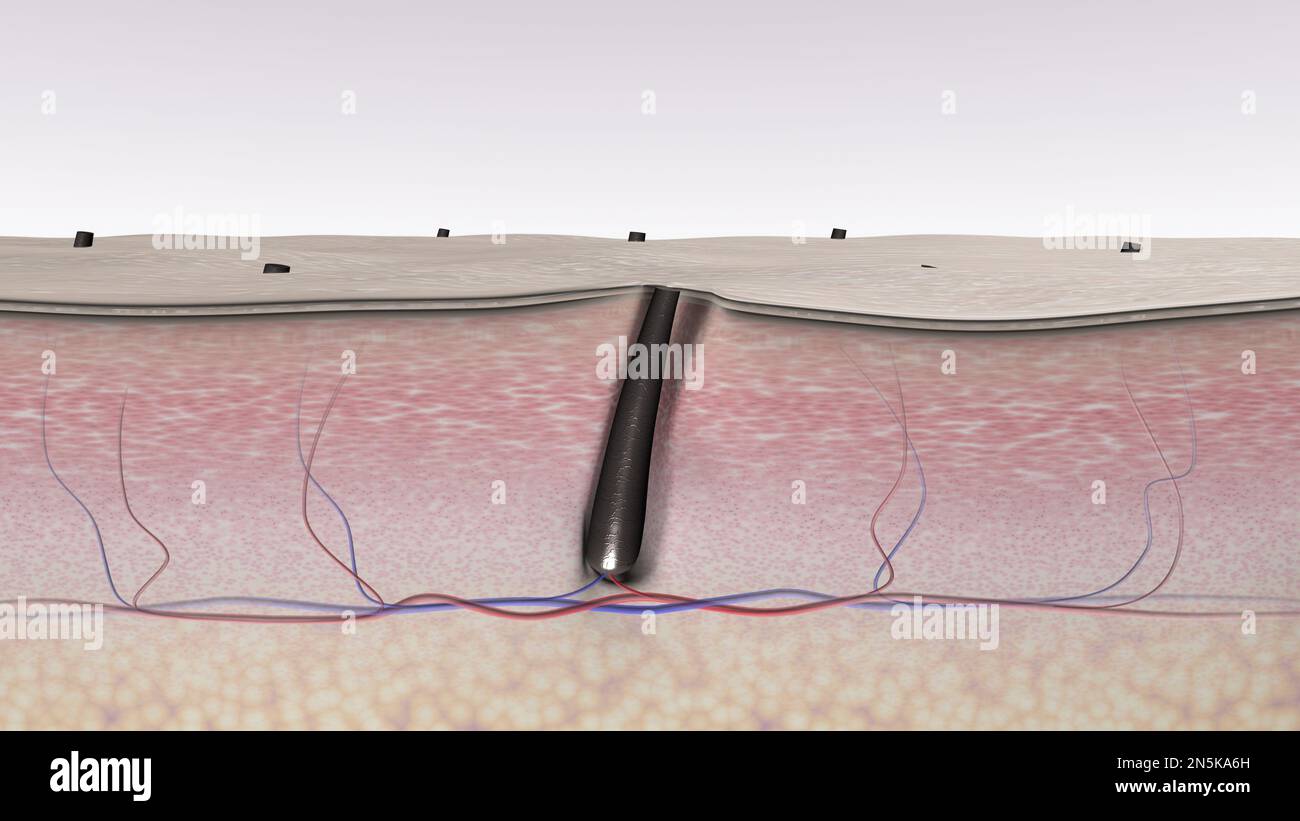 Cheveux sauvés. Coupe transversale des tissus cutanés et du follicule pileux après le rasage. Illustration médicale 3D Banque D'Images