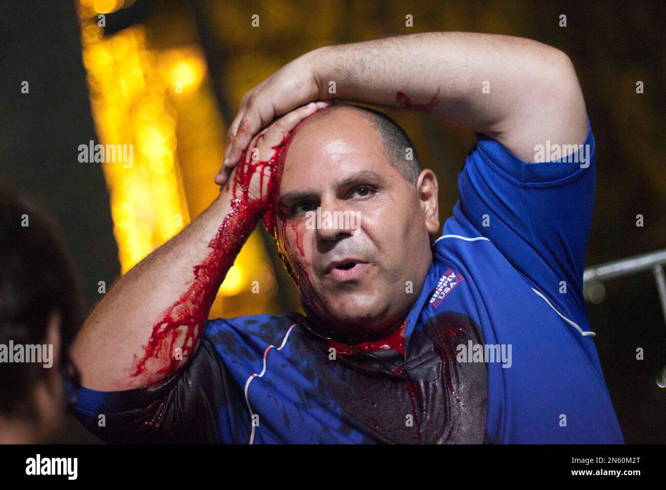 A wounded protester holds his bleeding head after being beaten by police officers while protesting the looting and insecurity during the days that the police went on strike in San Miguel de Tucuman, Argentina Tuesday, Dec. 10, 2013. Outbreaks of looting have spread across Argentina as mobs take advantage of strikes by police demanding pay raises to match inflation. Police called off the strike after receiving a salary increase Tuesday night. (AP Photo/Sol Almidez) Banque D'Images
