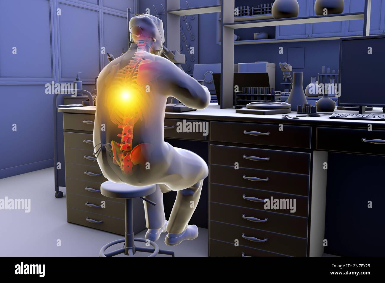 Troubles musculo-squelettiques chez les travailleurs de laboratoire, illustration Banque D'Images