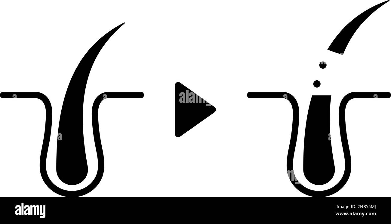 Section interstitielle avec poils rasés, illustration de l'épilation et de l'auto-traitement Illustration de Vecteur