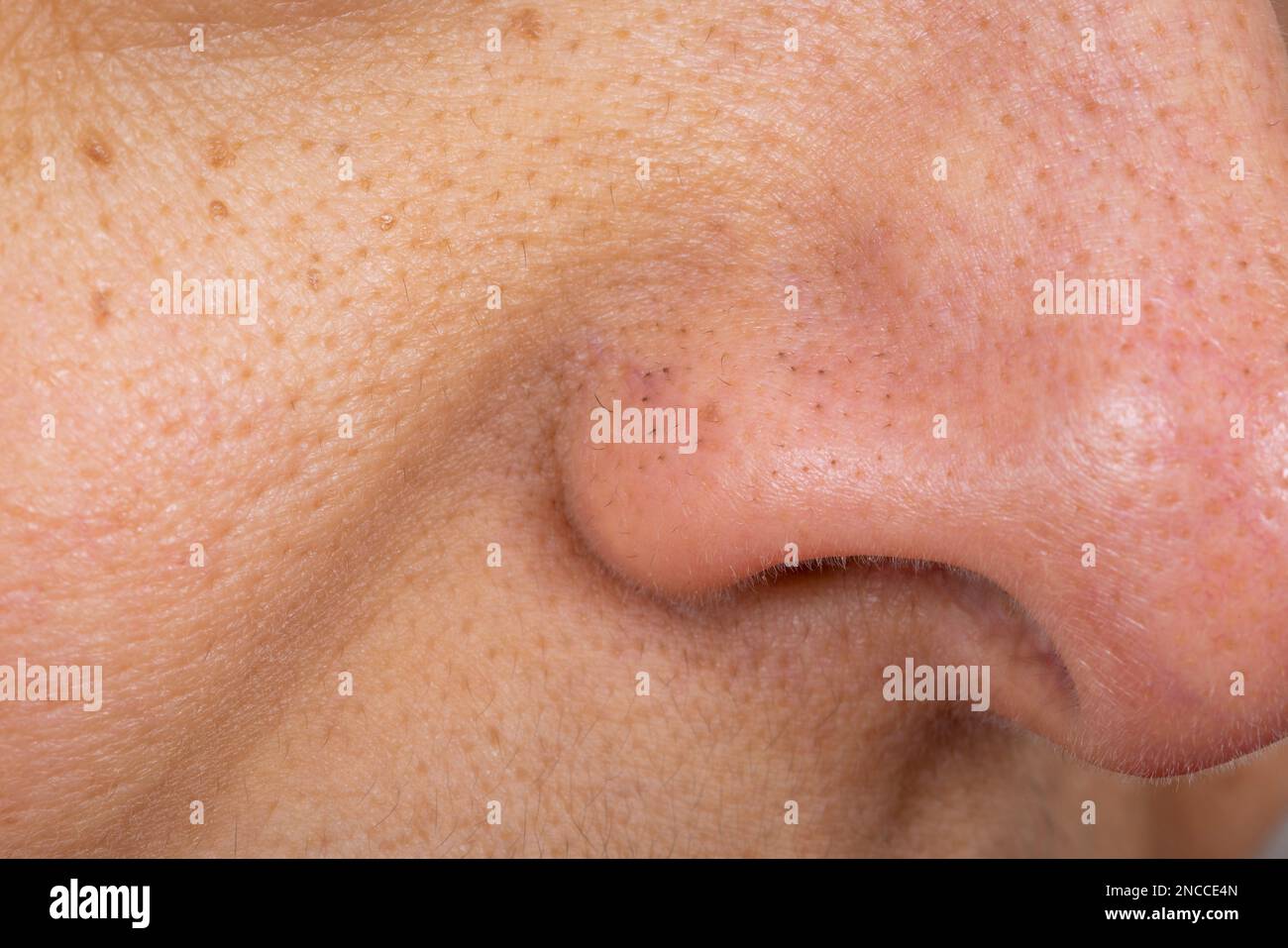 Pores obstrués et agrandis, gros plan du nez et du visage d'une femme asiatique indienne d'âge moyen Banque D'Images