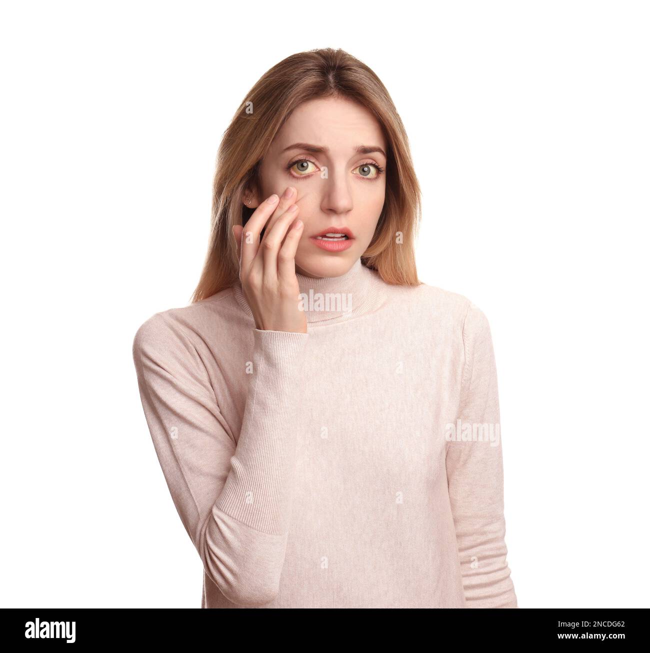 Femme vérifiant son état de santé sur fond blanc. Yeux jaunes comme symptôme de problèmes avec le foie Banque D'Images