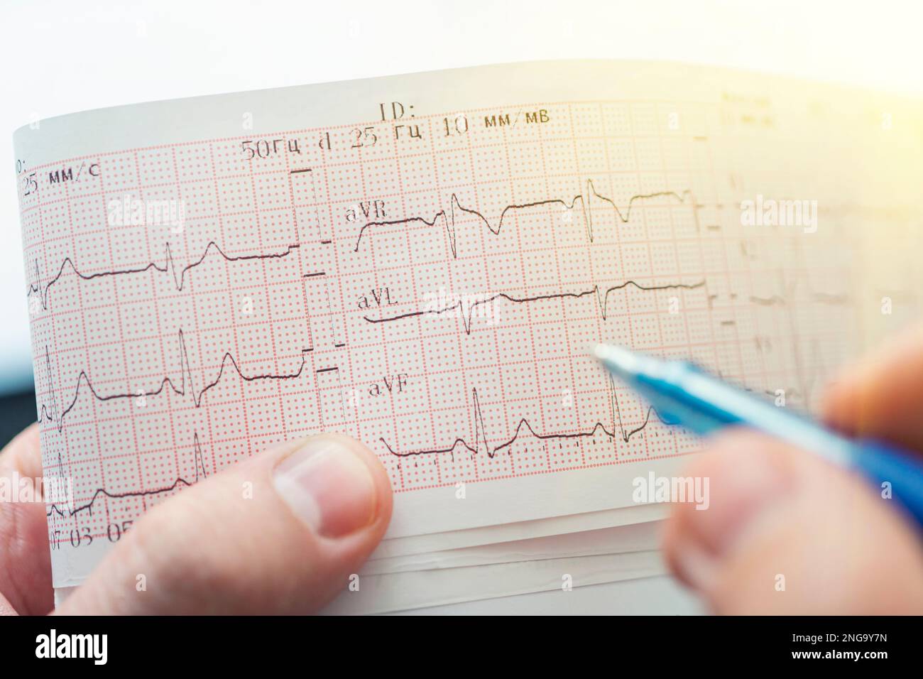 Électrocardiogramme. Main dans un gant médical tenant un stylo à bille. Gros plan Banque D'Images