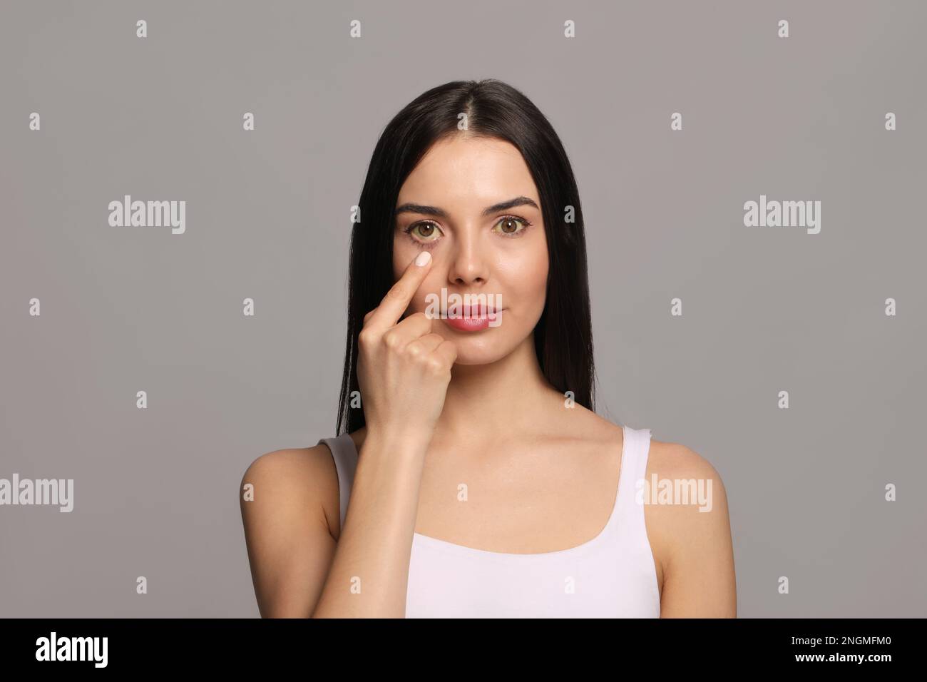 Femme vérifiant son état de santé sur fond gris. Yeux jaunes comme symptôme de problèmes avec le foie Banque D'Images