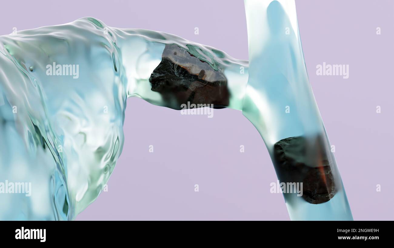 Calculs biliaires dans le canal biliaire, silhouette humaine et anatomie des organes environnants, foie et vésicule biliaire avec calculs, rendu réaliste 3D Banque D'Images