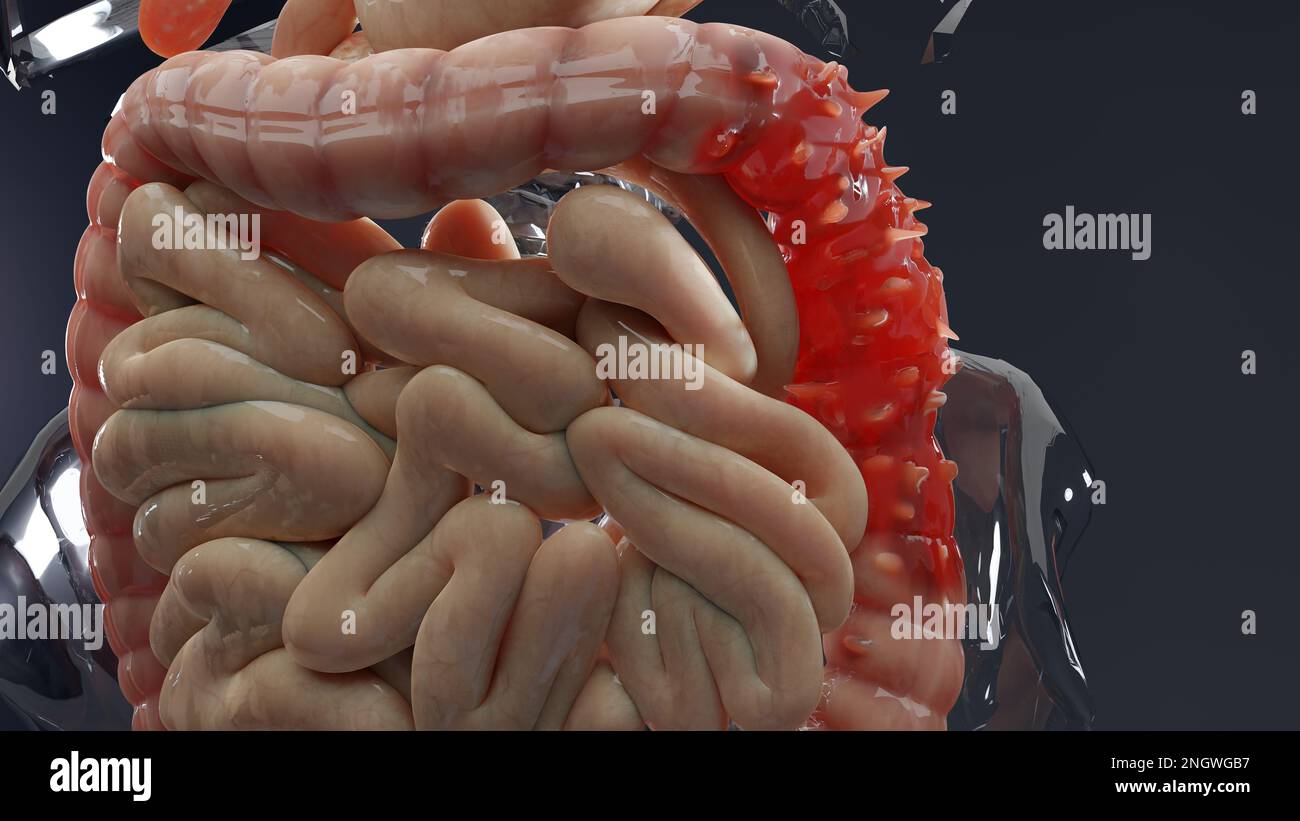 Anatomie du système digestif humain, concept de l'intestin, diverticulite, rendu 3D Banque D'Images