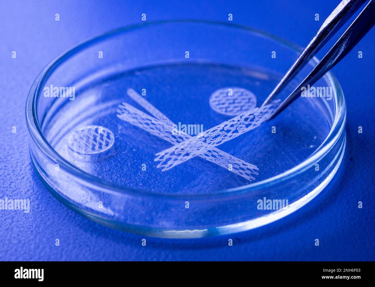 07 février 2023, Mecklembourg-Poméranie occidentale, Warnemünde : des stents spéciaux pour utilisation dans les trompes de Fallope sont placés sous microscope à l'Institut de technologie des implants et des biomatériaux (IIB). Au cours d'une visite, le ministre de la Santé de Mecklembourg-Poméranie occidentale apprend le développement d'un stent de trompe de Fallope qui est utilisé en cas d'infécondité involontaire à la suite d'un rétrécissement des trompes de Fallope. Photo: Jens Büttner/dpa Banque D'Images