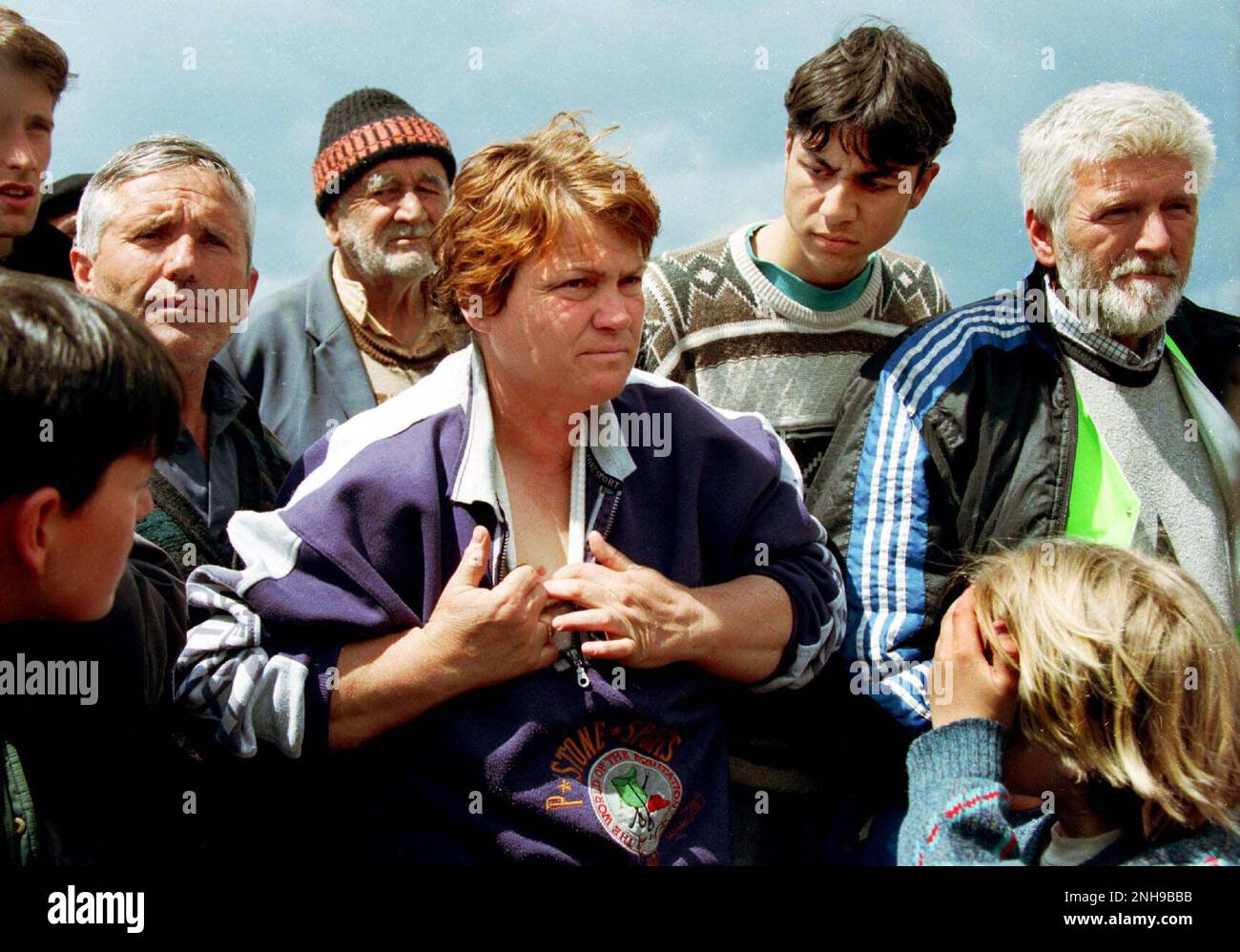 La femme albanaise-kosovare montre une cicatrice résultant de la blessure par balle reçue tout en étant nettoyée ethniquement du Kosovo. Camp de réfugiés de Brazda en Macédoine avril 1999. Le camp était dirigé par l'OTAN mais remis au HCR. Macédoine. Figure garyrobertsphotography.com Banque D'Images