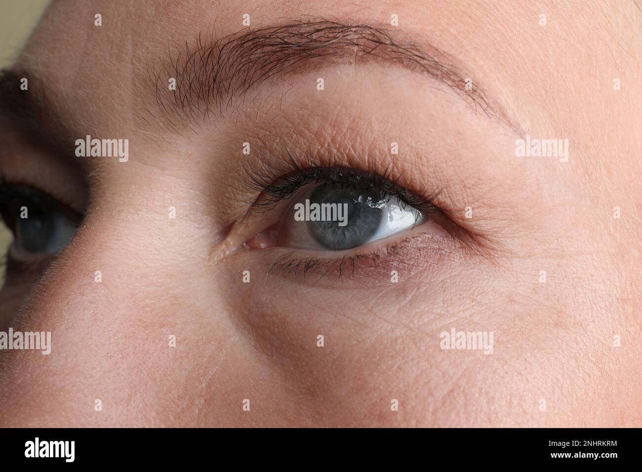 Vue en gros plan de la femme adulte avec cataracte oculaire Banque D'Images