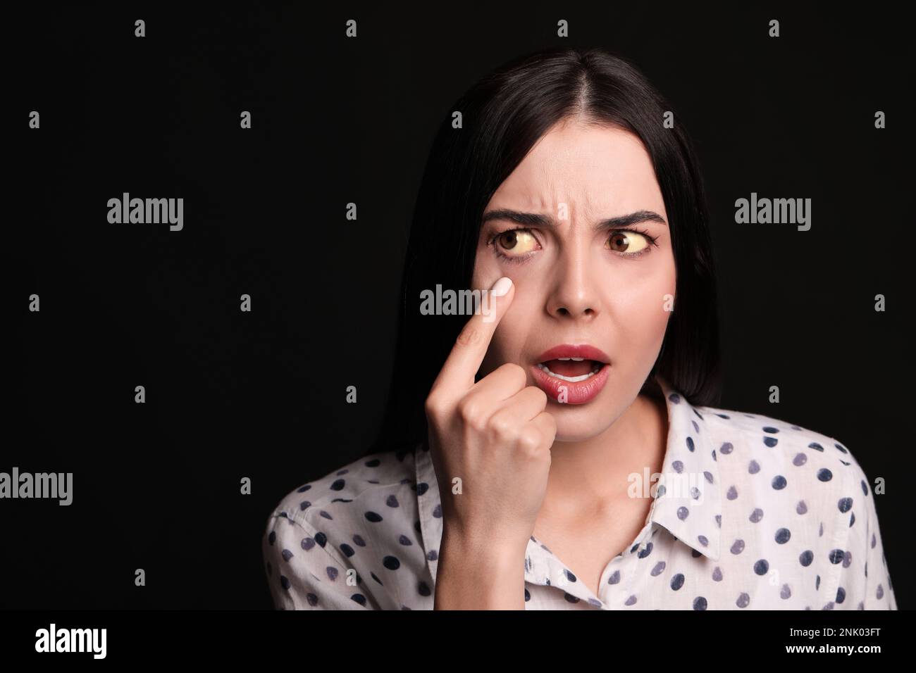 Femme vérifiant son état de santé sur fond noir, espace pour le texte. Yeux jaunes comme symptôme de problèmes avec le foie Banque D'Images