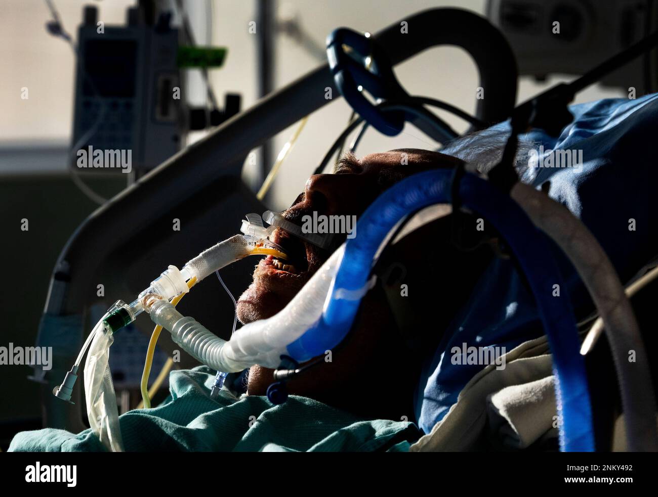 A COVID-19 patient is ventilated in the intensive care unit at the Humber River Hospital during the COVID-19 pandemic in Toronto on Tuesday, Jan. 25, 2022. (Nathan Denette /The Canadian Press via AP) Banque D'Images