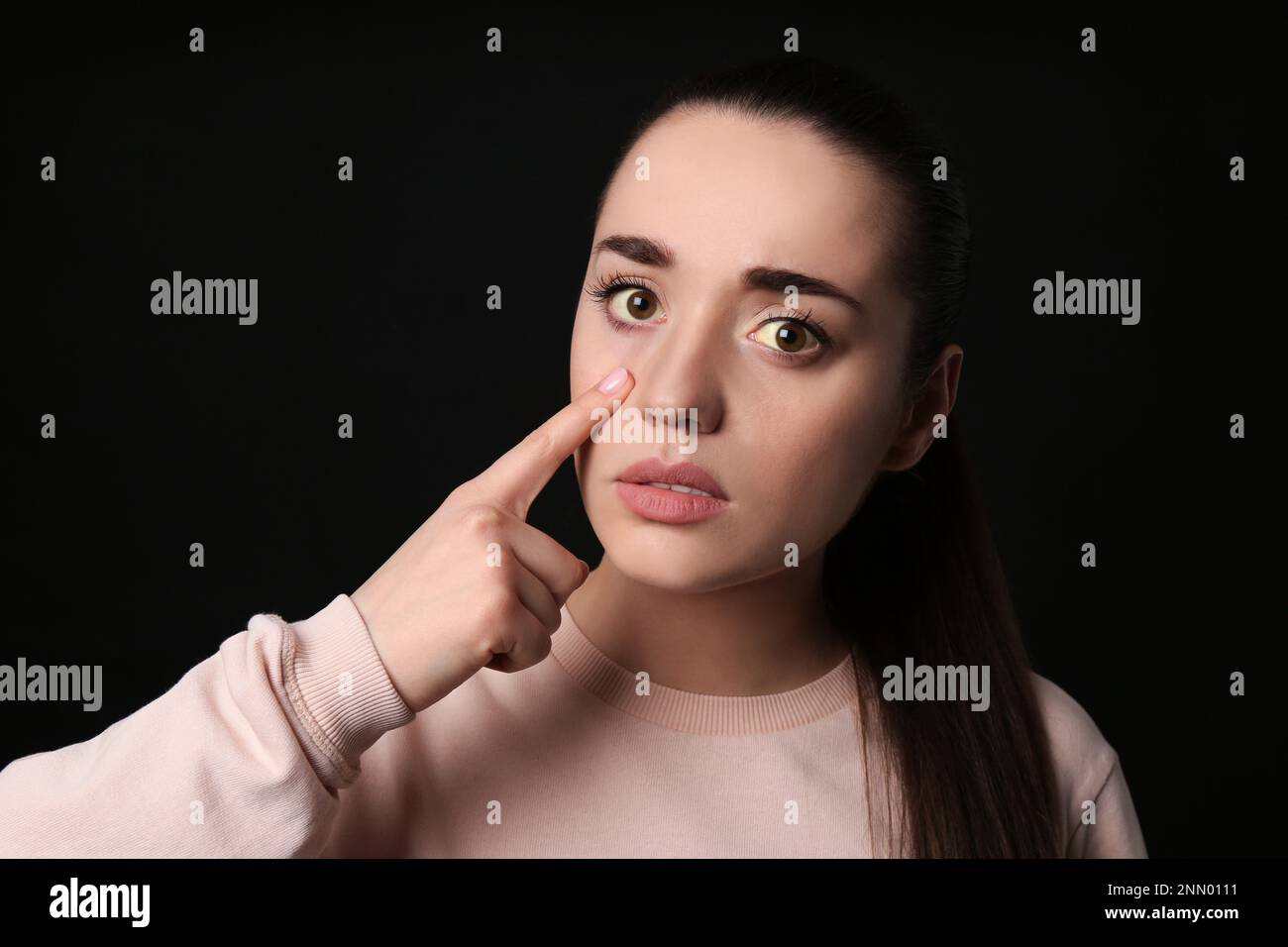 Femme vérifiant son état de santé sur fond noir. Yeux jaunes comme symptôme de problèmes avec le foie Banque D'Images
